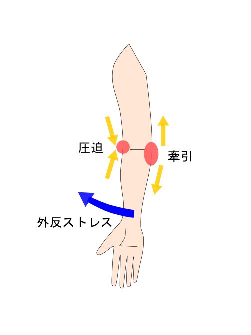 肘の外販