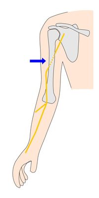 橈骨神経の経路
