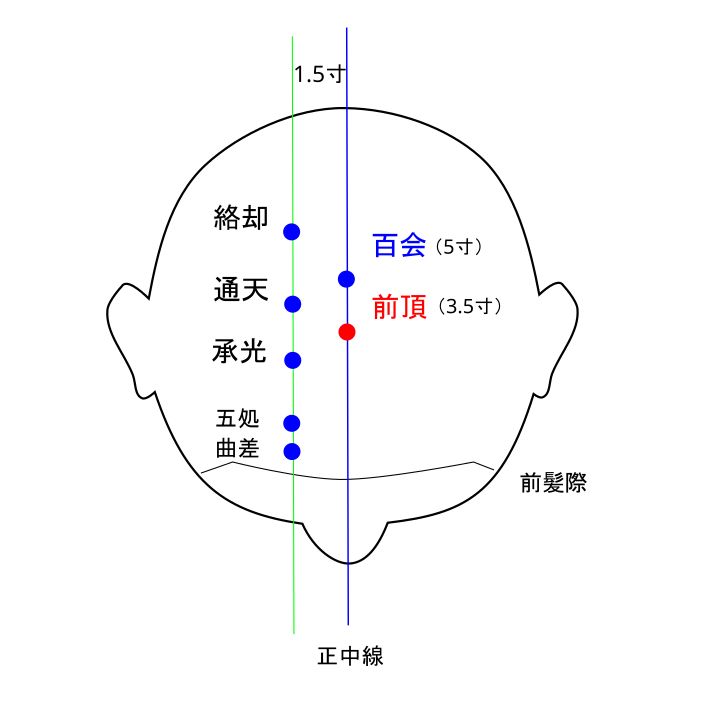 前頂（ぜんちょう）穴イラストと督脈
