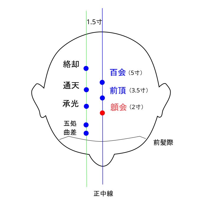 顖会(しんえ)穴イラストと督脈