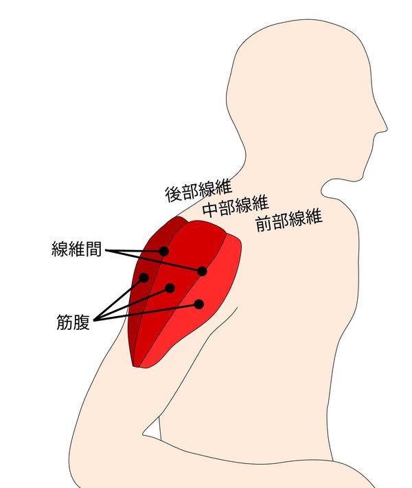 三角筋への鍼