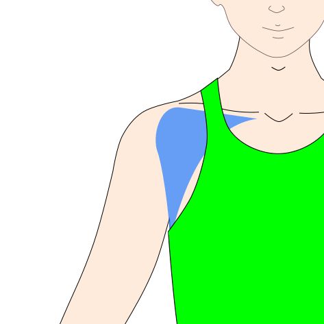 大胸筋・小胸筋へのアプローチイラスト