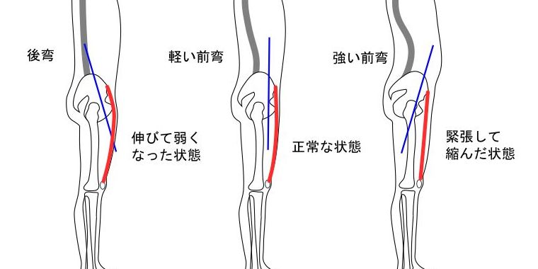 大腿四頭筋と姿勢イラスト